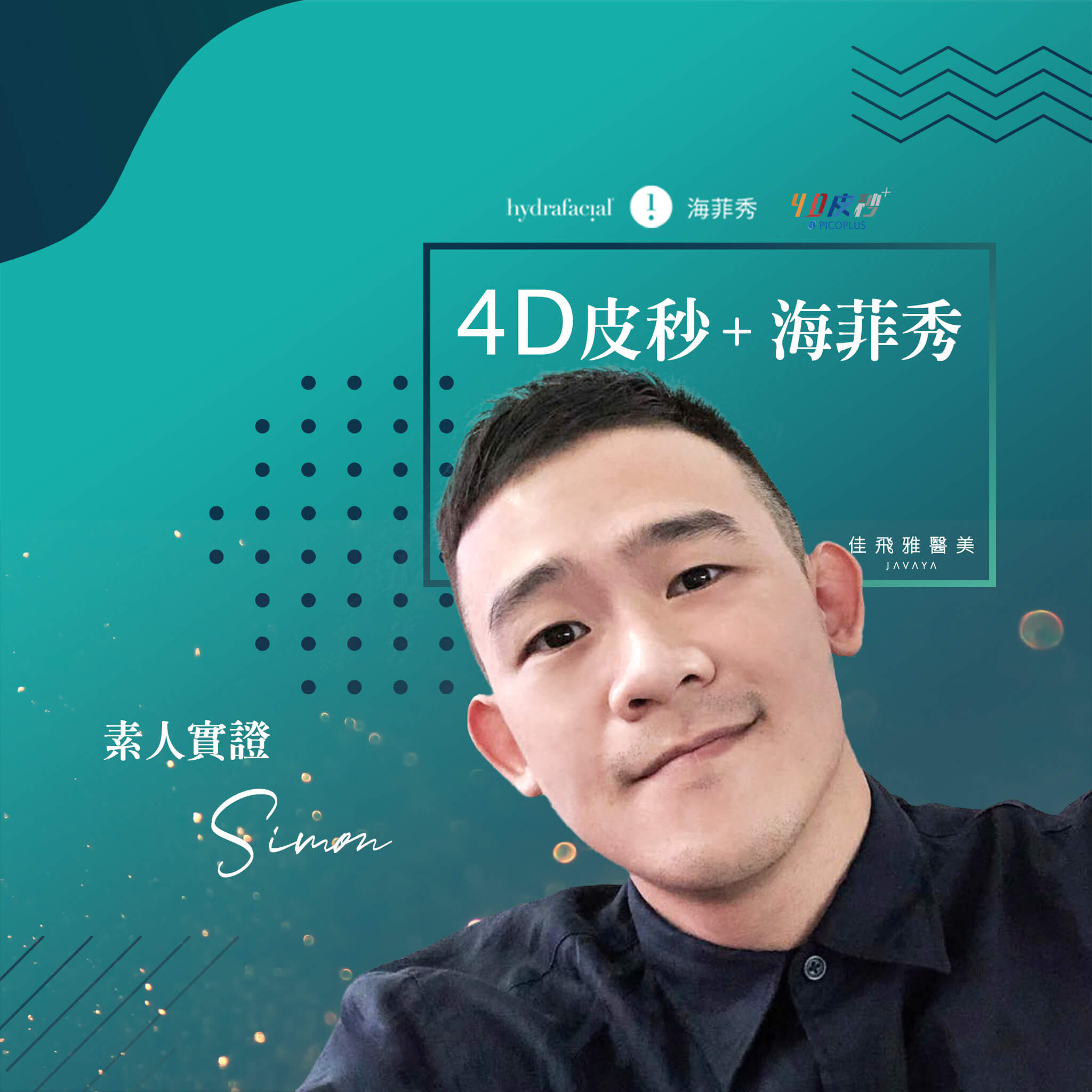 4D PicoPlus+海菲秀實證案例-素人實證-Simon | 佳飛雅醫美