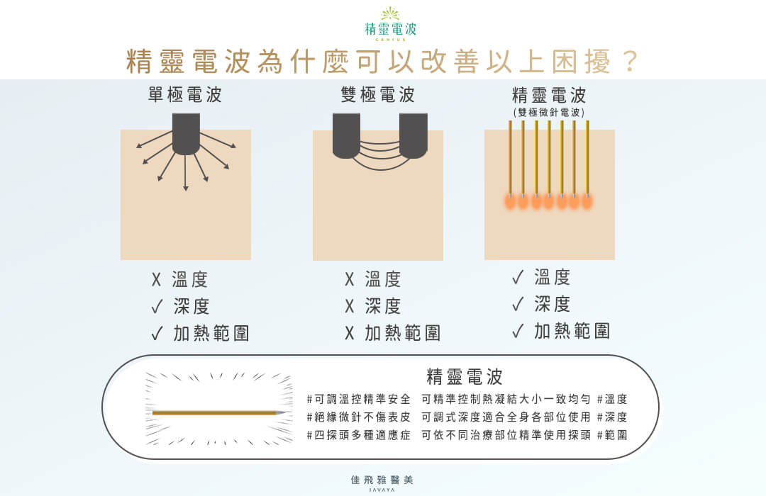 精靈電波 為什麼可以改善以上困擾? | 佳飛雅醫美