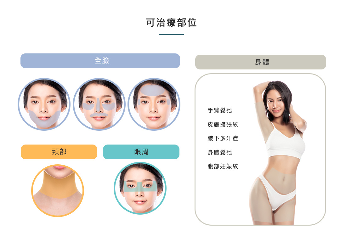 精靈電波 可治療部位 | 佳飛雅醫美