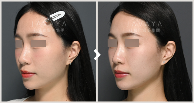 海芙電波｜見證案例