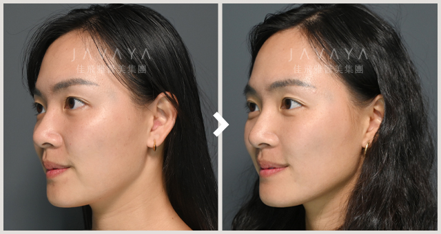 海芙電波｜見證案例