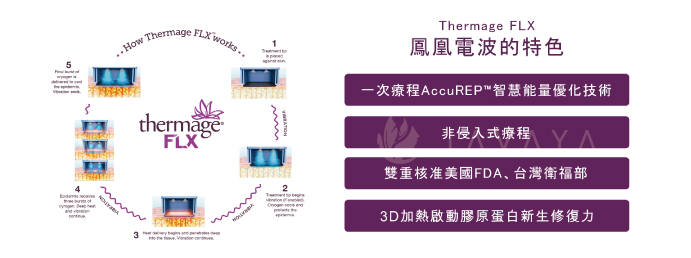 第四代鳳凰電波 特色與優勢 | 佳飛雅醫美