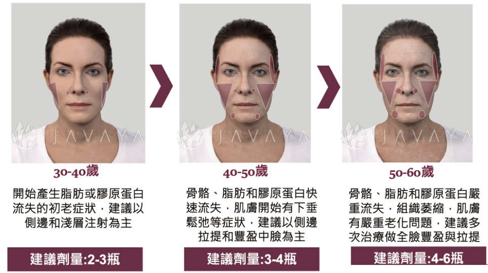 舒顏萃治療劑量建議 | 佳飛雅醫美