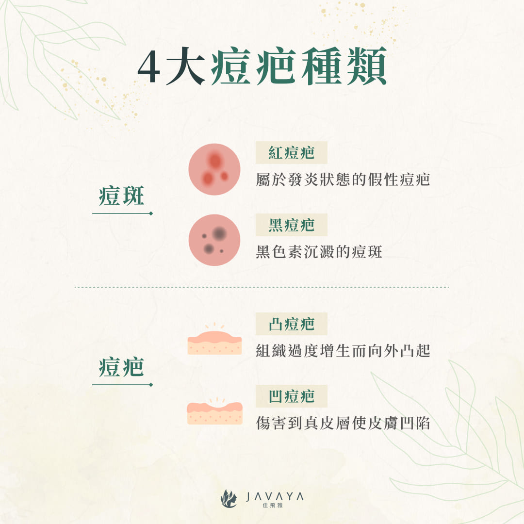 4大痘疤種類:紅痘疤、黑痘疤、凸痘疤、凹痘疤