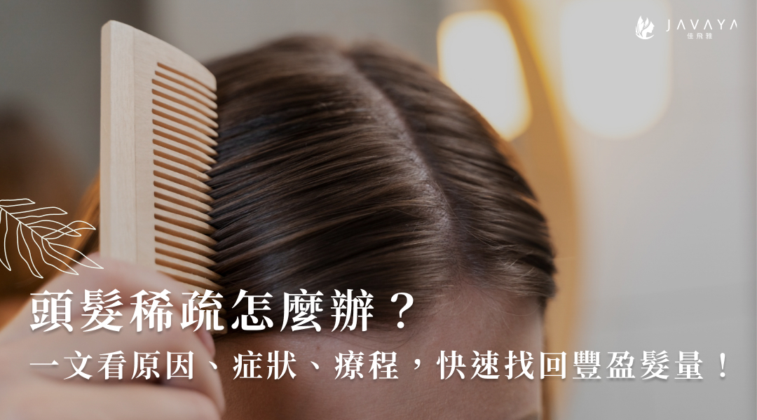 頭髮稀疏怎麼辦？一文看原因、症狀、療程，快速找回豐盈髮量！