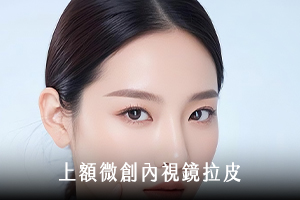 上額微創內視鏡拉皮手術