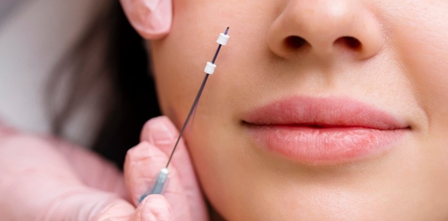 埋線原理：法令紋/嘴邊肉分區應用？線材層次與90%風險管理