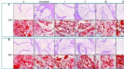 膠原蛋白增生劑