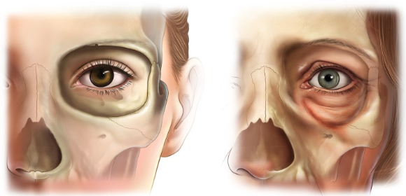 眼周電波費用,眼周電波比較,眼周電波