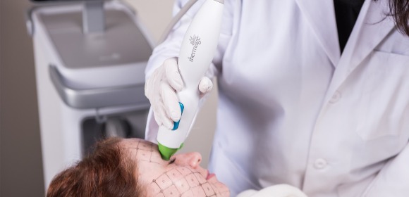 眼周電波費用,眼周電波比較,眼周電波