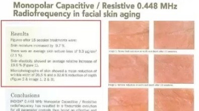 膠原蛋白增生劑