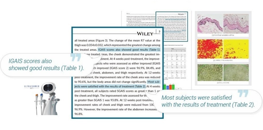 媚必提海芙音波第四代|不動刀也能精緻上鏡,輪廓更俐落!