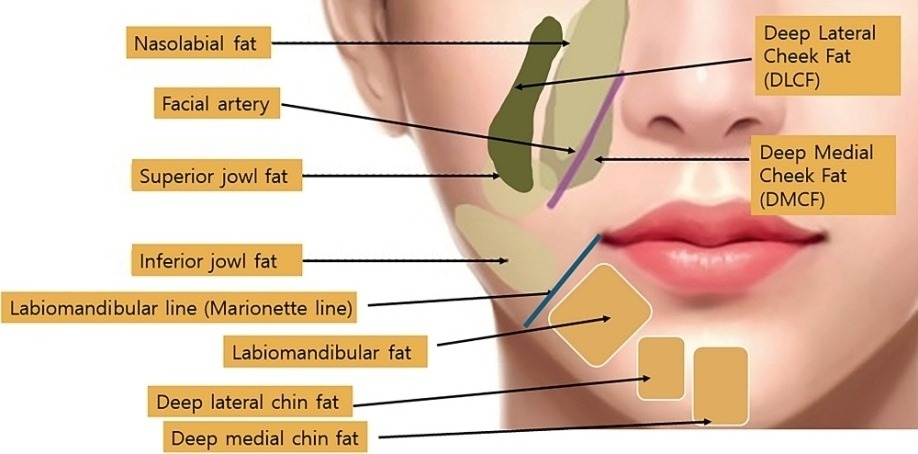 埋線原理：法令紋/嘴邊肉分區應用？線材層次與90%風險管理